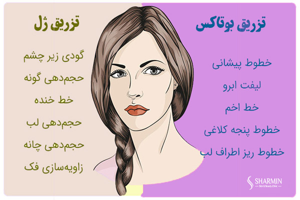 تزریق بوتاکس - کلینیک شارمین
