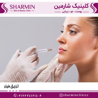 تزریق فیلر - کلینیک شارمین