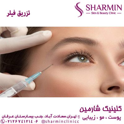 تزریق فیلر - کلینیک شارمین