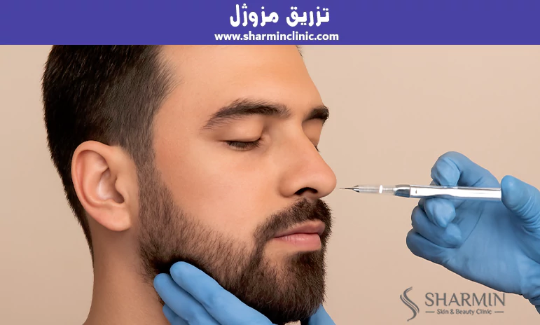 تزریق مزوژل