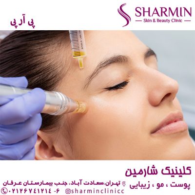 پی آر پی - کلینیک شارمین