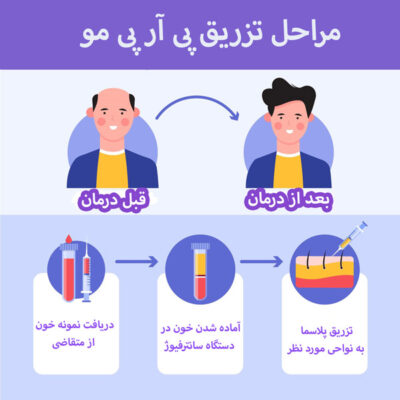 پی آر پی - کلینیک شارمین
