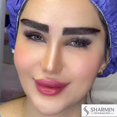 مراقبت های بعد از کاشت ابرو