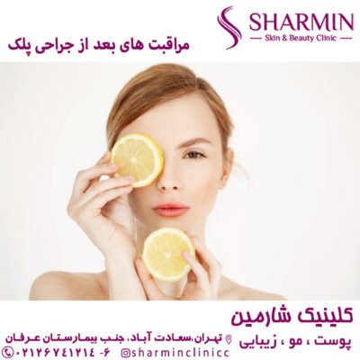 مراقبت های بعد از جراحی پلک - کلینیک شارمین