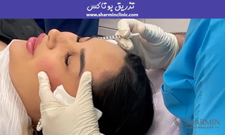 تزریق بوتاکس