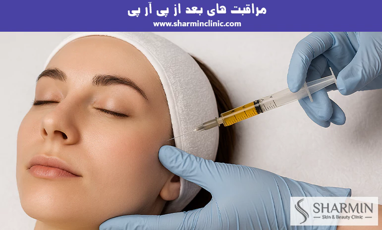 مراقبت های بعد از پی آر پی