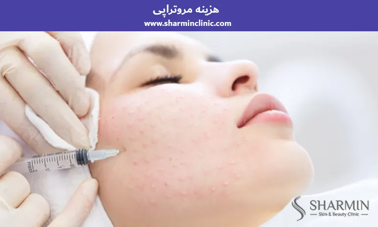هزینه مزوتراپی