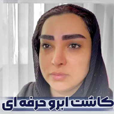 آیا کاشت ابرو دائمی است؟