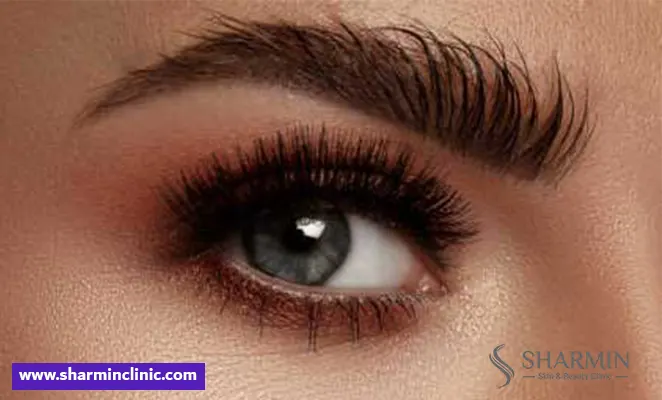علت سیخ سیخ شدن ابرو پس از کاشت