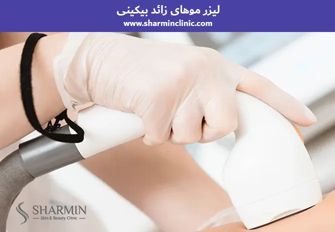 لیزر موهای زائد بیکینی