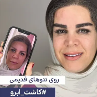 ماندگاری کاشت ابرو