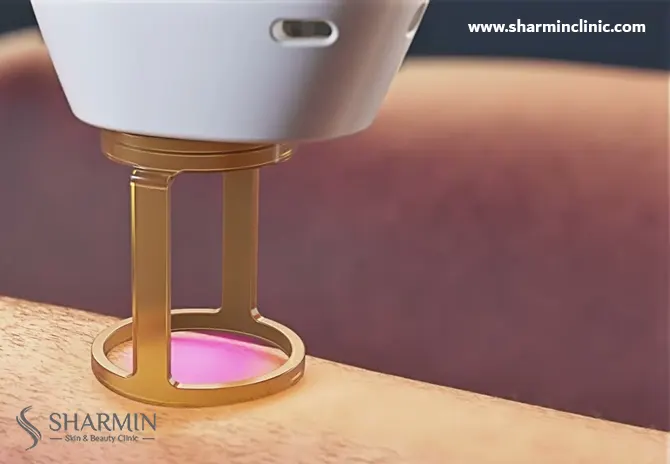 هزینه لیزر موهای زائد بیکینی