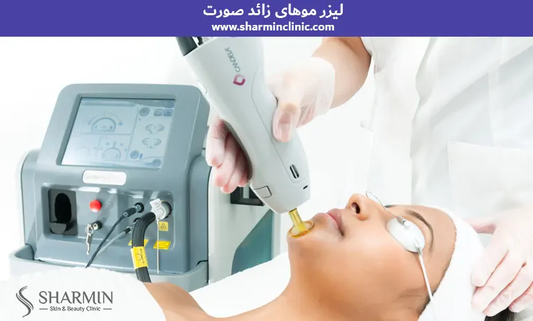 لیزر موهای زائد صورت