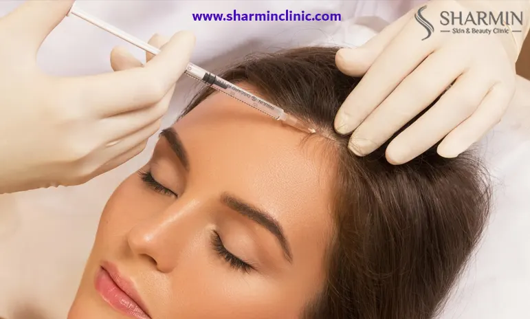 مزایای مزوتراپی بعد از کاشت مو مزایای مزوتراپی بعد از کاشت مو