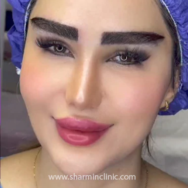 کاشت ابرو کلینیک آسو