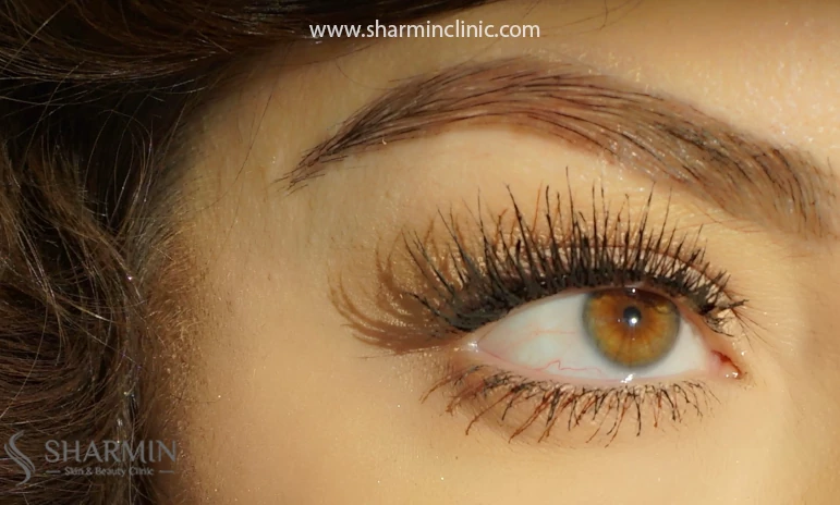 خارش ابرو بعد از کاشت نشانه عفونت است؟
