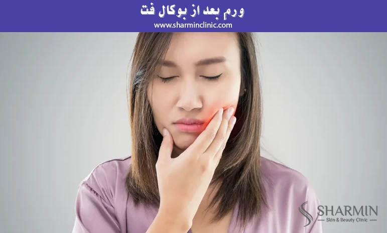 ورم بعد از بوکال فت