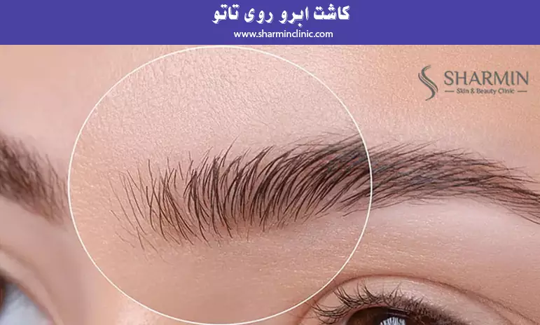 کاشت ابرو روی تاتو