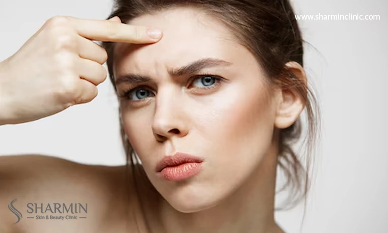 آیا جوش و دلمه بعد از کاشت ابرو طبیعی است؟