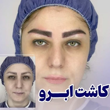 مزایا و معایب کاشت ابرو در بارداری