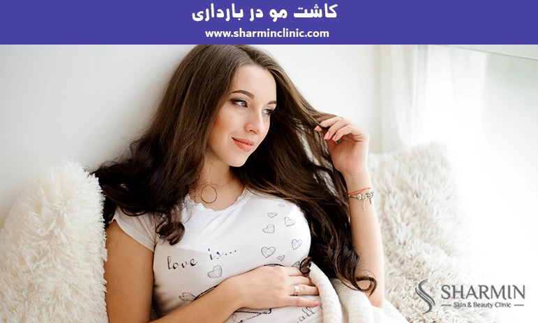 کاشت مو بارداری