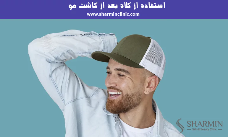 استفاده از کلاه بعد از کاشت مو