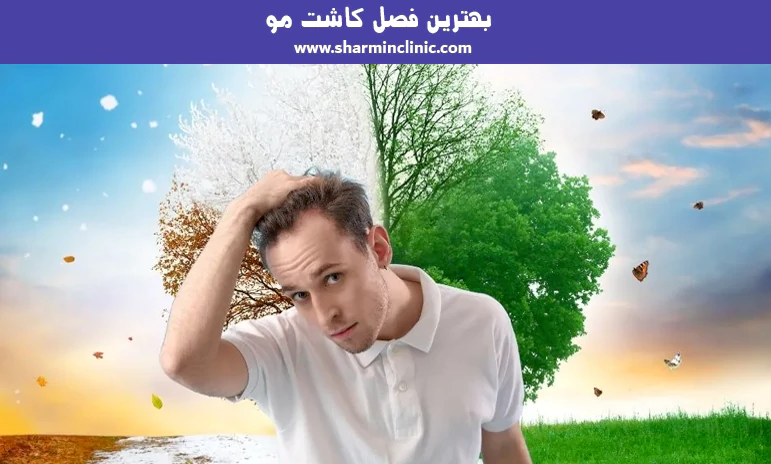 بهترین فصل کاشت مو