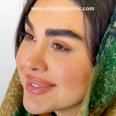 بهترین کلینیک کاشت ابرو تهران
