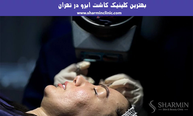 بهترین کلینیک کاشت ابرو در تهران