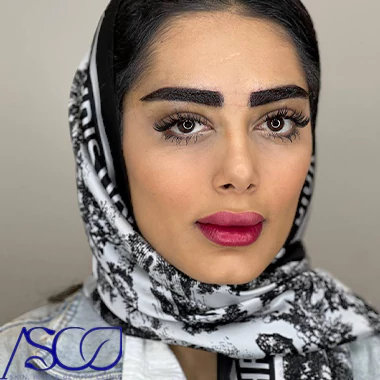 عکس ابروی کاشت شده عکس ابروی کاشت شده
