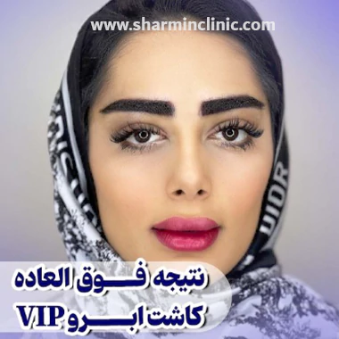 نمونه کار بهترین کلینیک کاشت ابرو در تهران