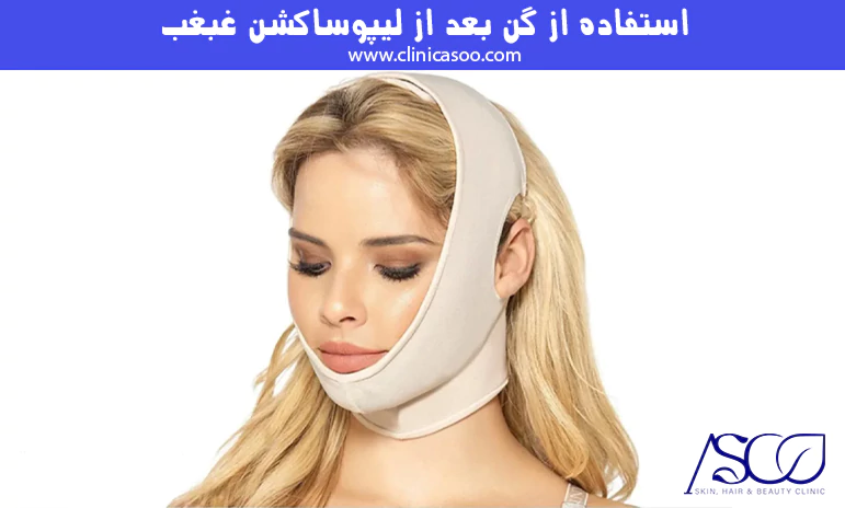 مراحل مراقبت بعد از لیپوساکشن غبغب