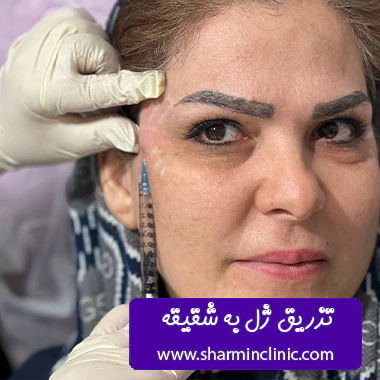 نمونه کار تزریق ژل کلینیک شارمین