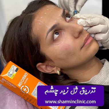 نمونه کار تزریق ژل