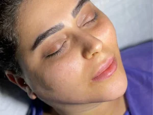 نمونه کار لیپوفیس