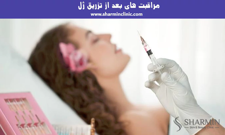 مراقبت های بعد از تزریق ژل