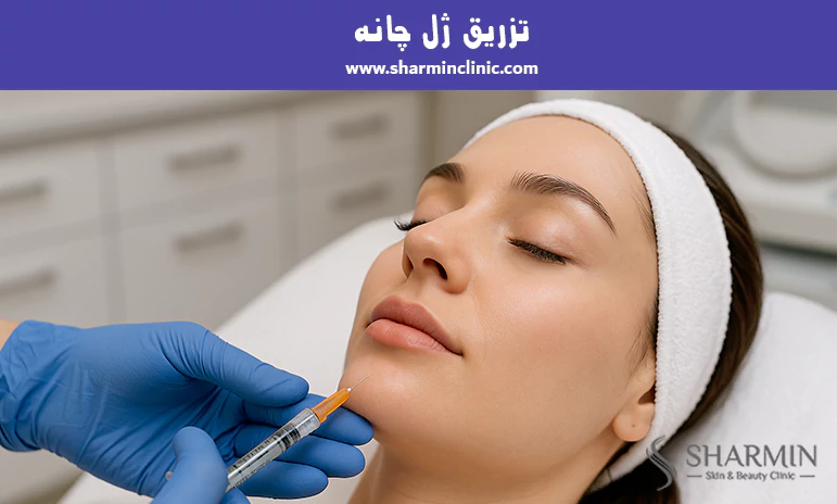 تزریق ژل چانه