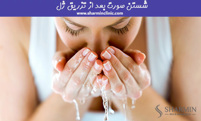 شستن صورت بعد از تزریق ژل