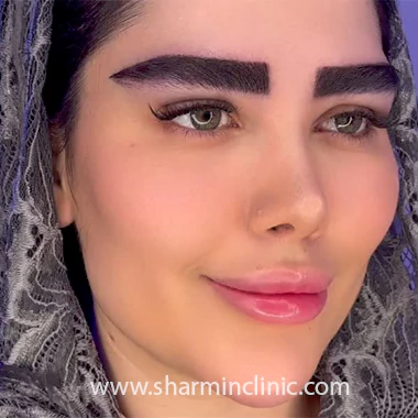 بهترین کلینیک کاشت ابرو سعادت آباد