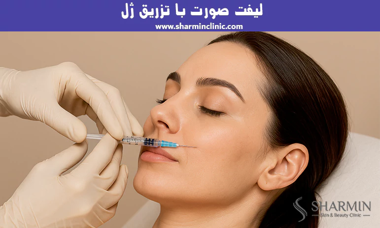 لیفت صورت با تزریق ژل